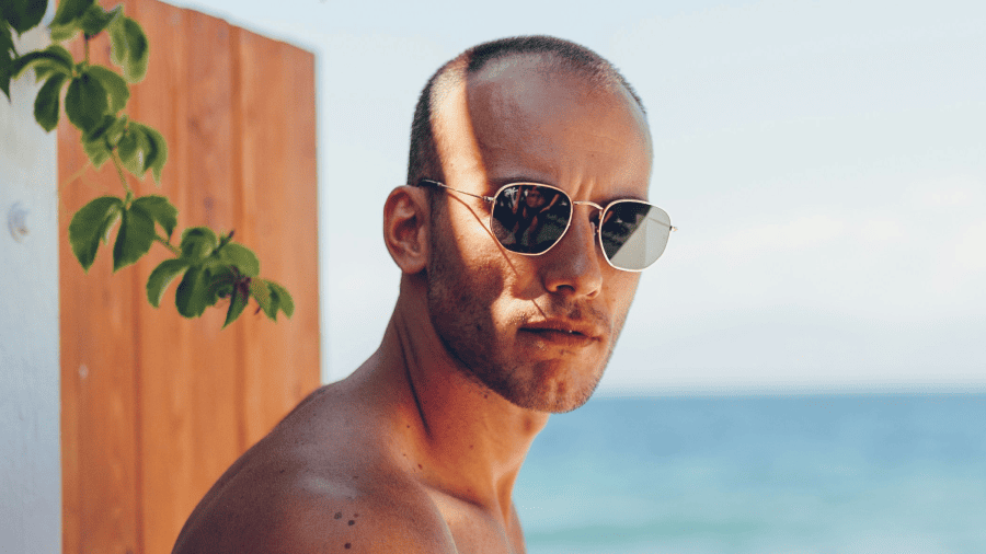 calvície masculina: causas, cuidados e autoestima